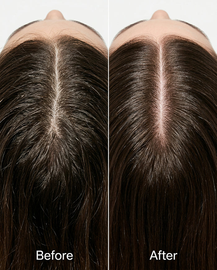 Does Prebiotic Shampoo Actually Help Your Scalp?